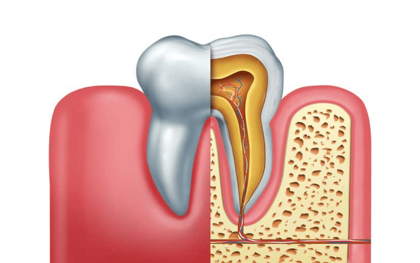 root canal infection signs