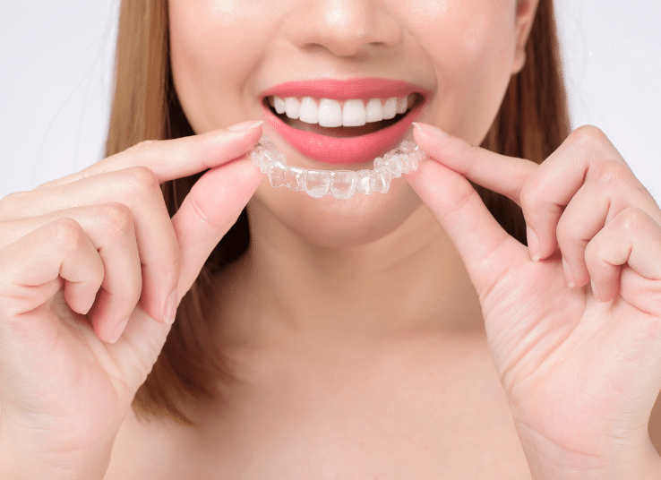 Invisalign Improves Your Bite Comfortably